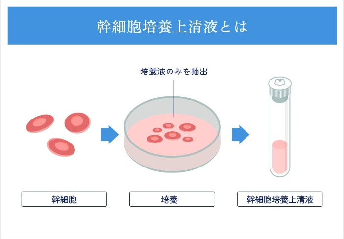 幹細胞培養上清液とは