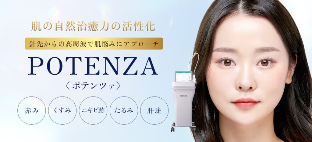 ポテンツァアイキャッチ