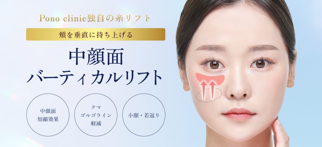 中顔面バーティカルリフト