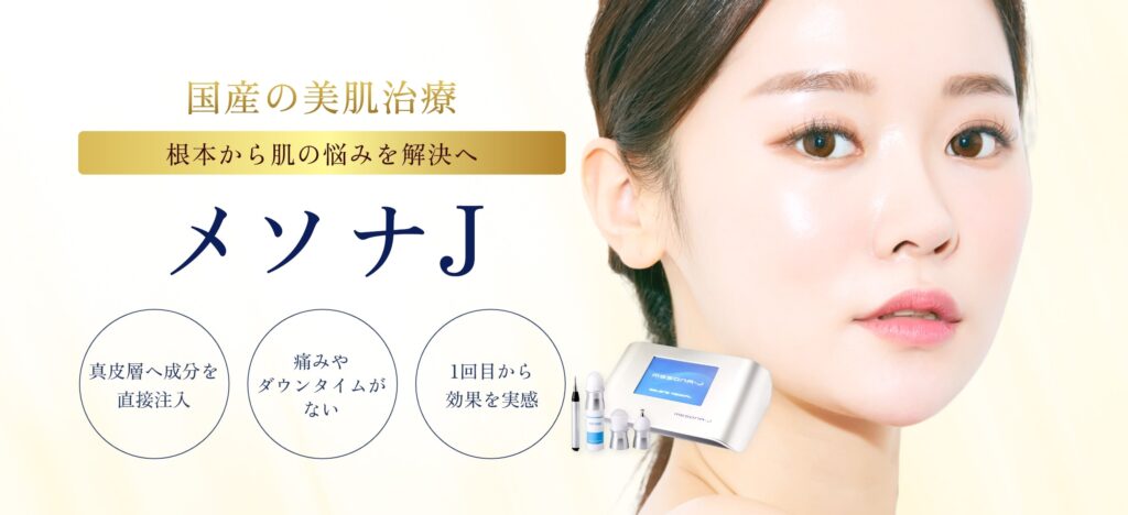 メソナJ-アイキャッチ