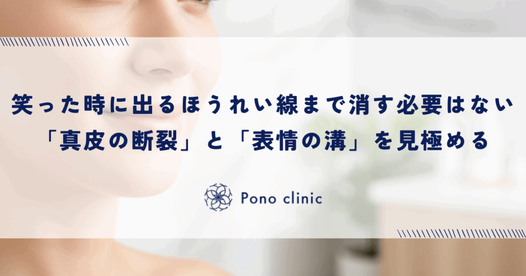 笑った時に出るほうれい線まで消す必要はない理由｜「真皮の断裂」と「表情の溝」を見極める