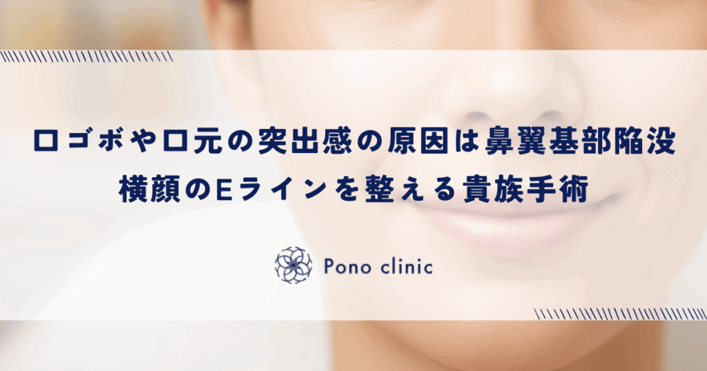 口ゴボや口元の突出感は「鼻翼基部の陥没」が原因｜横顔のEラインを整える貴族手術の適応