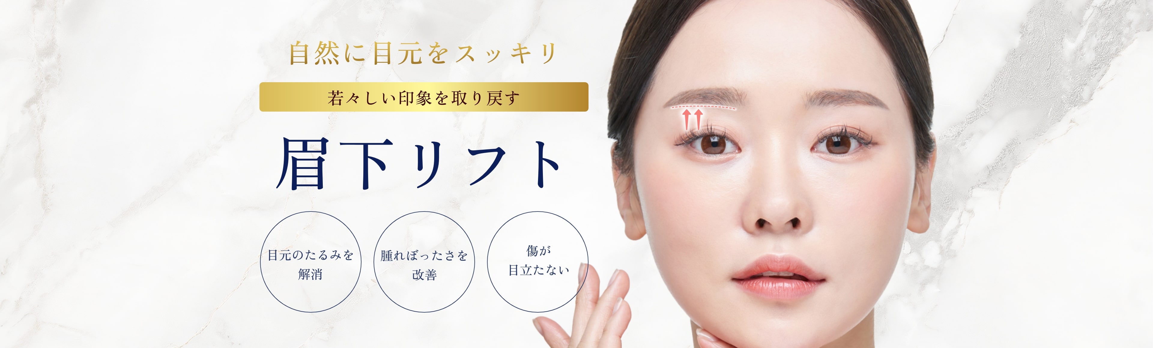 眉下リフトmv-pc