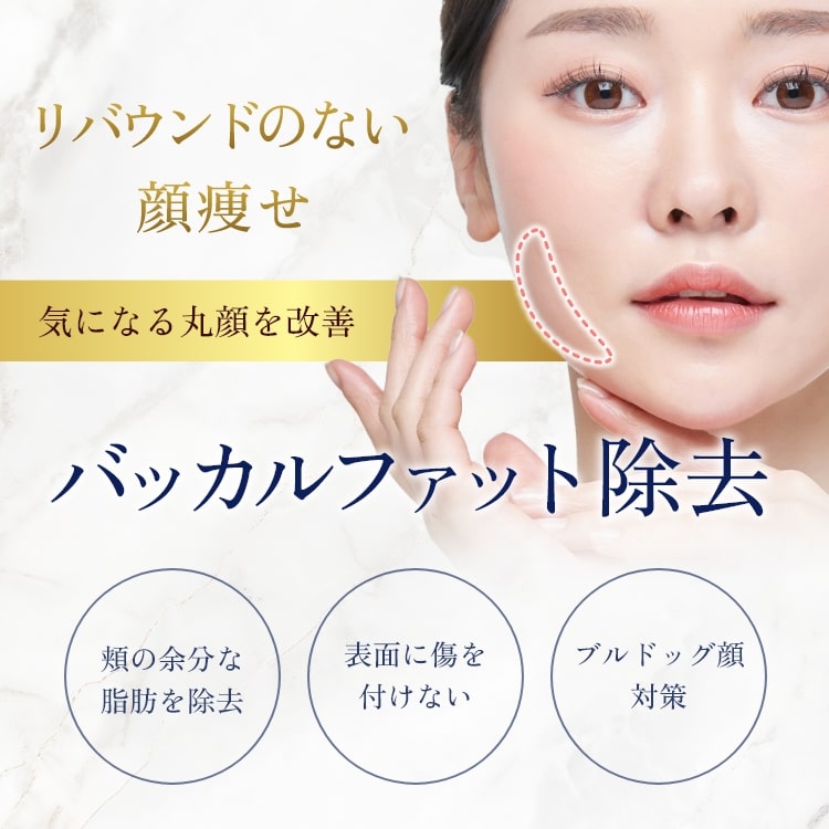 バッカルファット除去