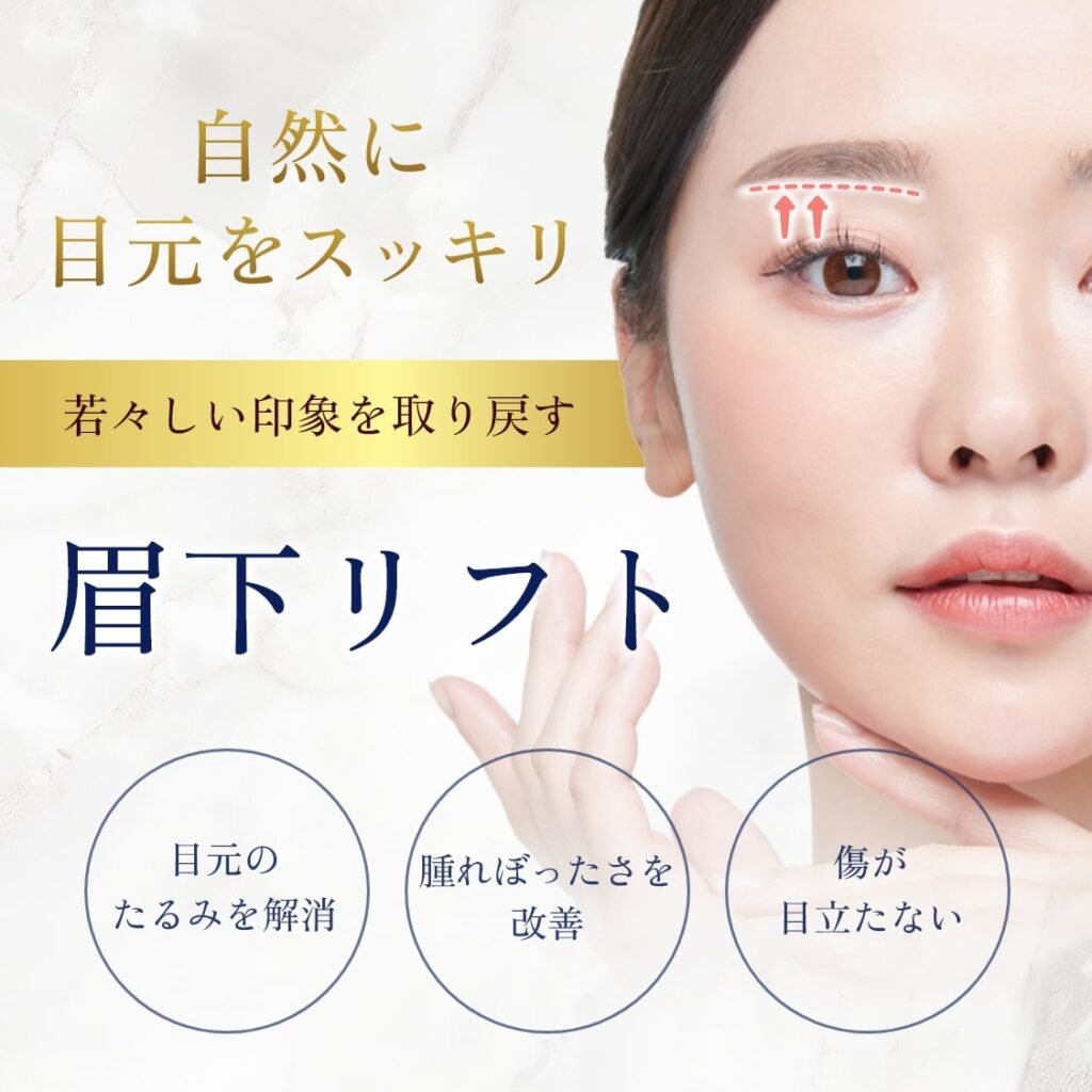 眉下リフトmv-sp