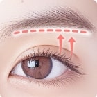 眉下リフト-icon