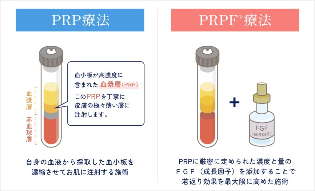 PRP療法とPRPF®療法