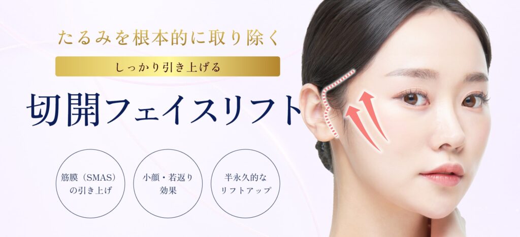 切開フェイスリフト