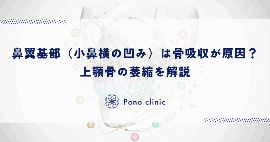 鼻翼基部（小鼻横の凹み）は骨吸収が原因？上顎骨の萎縮を解説