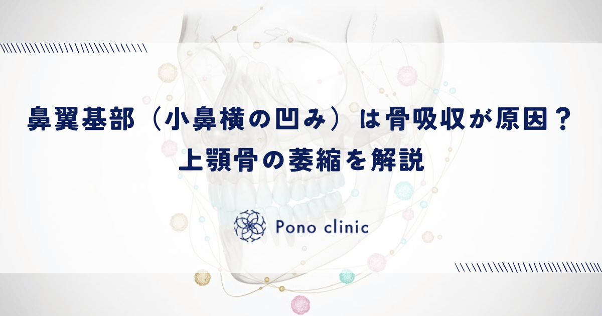 鼻翼基部（小鼻横の凹み）は骨吸収が原因？上顎骨の萎縮を解説