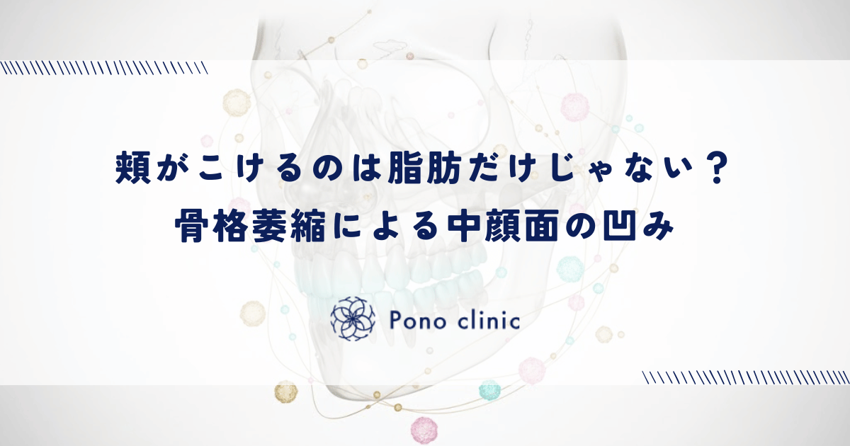 頬がこけるのは脂肪だけじゃない?骨格萎縮による中顔面の凹み