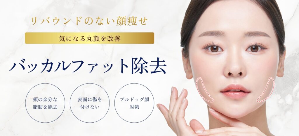 バッカルファット除去