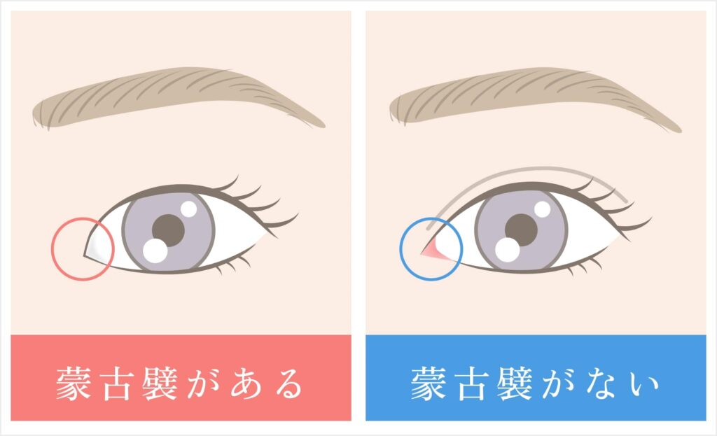 蒙古壁あるなしイラスト