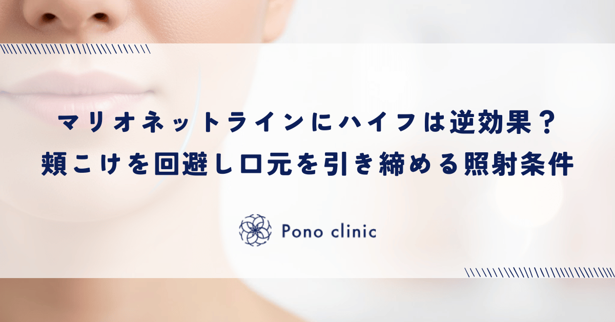 マリオネットラインにハイフ（HIFU）は逆効果？｜「頬こけ」を回避し口元を引き締める照射条件