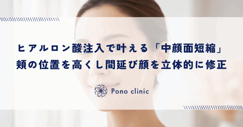 ヒアルロン酸注入で叶える「中顔面短縮」｜頬の位置（チークトップ）を高くし間延び顔を立体的に修正