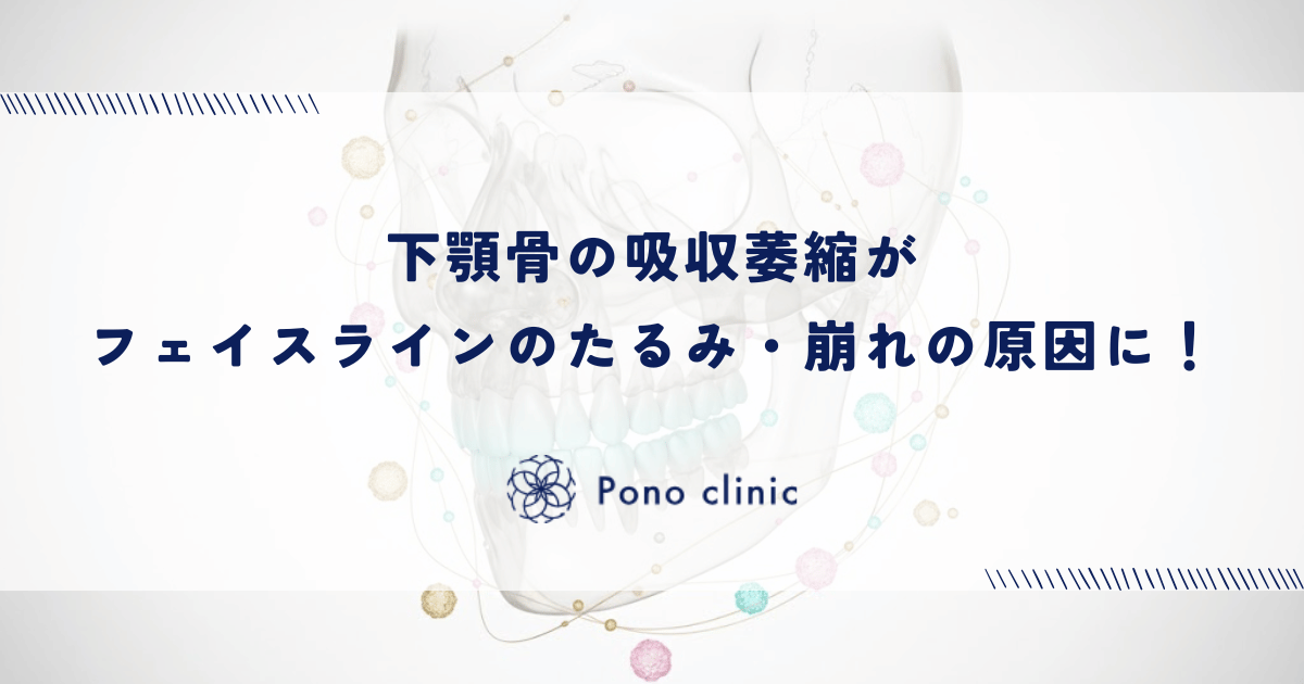 下顎骨の吸収萎縮がフェイスラインのたるみ・崩れの原因に!あご周りの骨格変化を解説