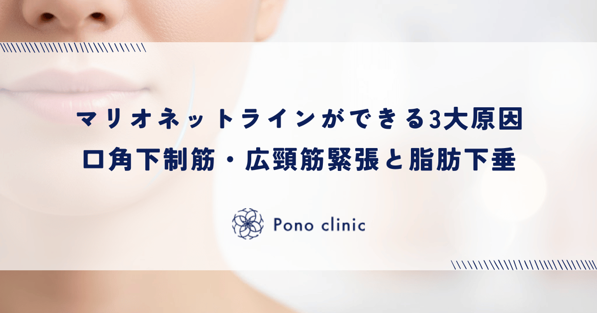 マリオネットラインができる3大原因｜口角下制筋・広頸筋の緊張と脂肪の下垂メカニズム