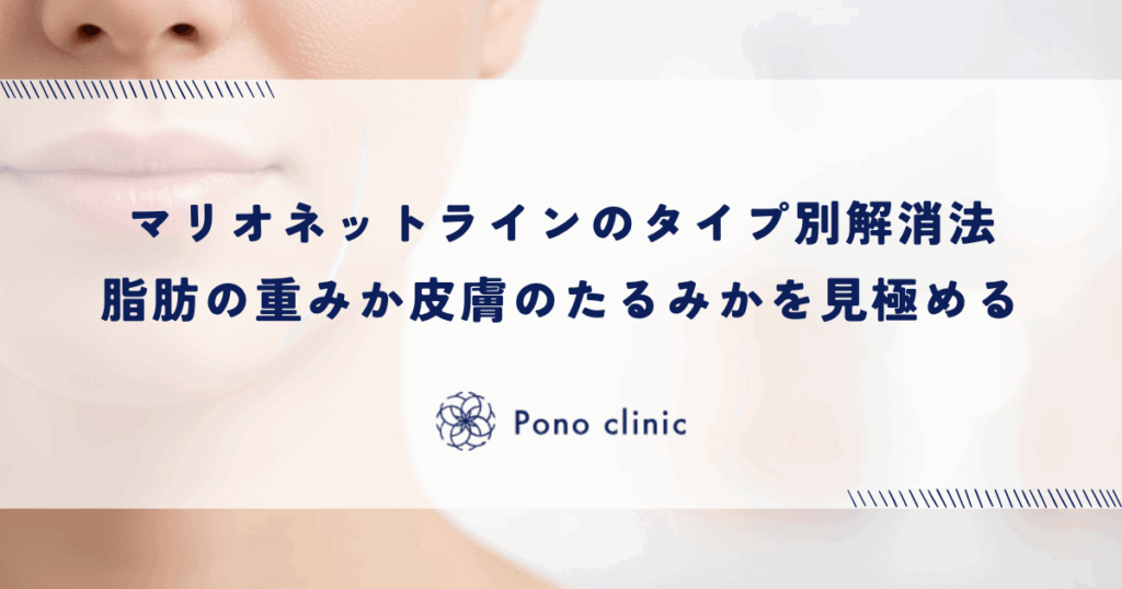 マリオネットラインのタイプ別解消法｜脂肪の重みか皮膚のたるみかを見極めて適切な治療を選ぶ