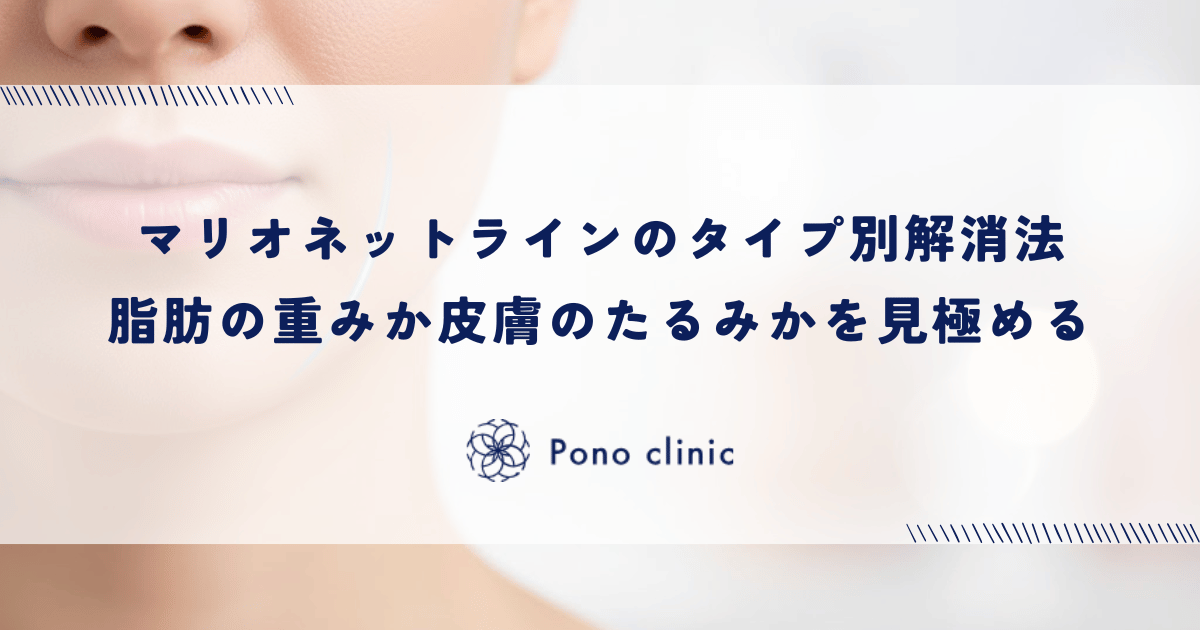 マリオネットラインのタイプ別解消法｜脂肪の重みか皮膚のたるみかを見極めて適切な治療を選ぶ