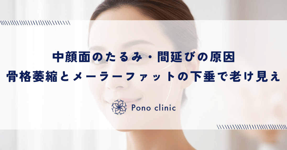 中顔面のたるみ・間延びの原因｜骨格の萎縮とメーラーファットの下垂による老け見え
