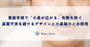 貴族手術で「小鼻が広がる」失敗を防ぐ｜鼻翼への干渉を避けるデザインと小鼻縮小との併用