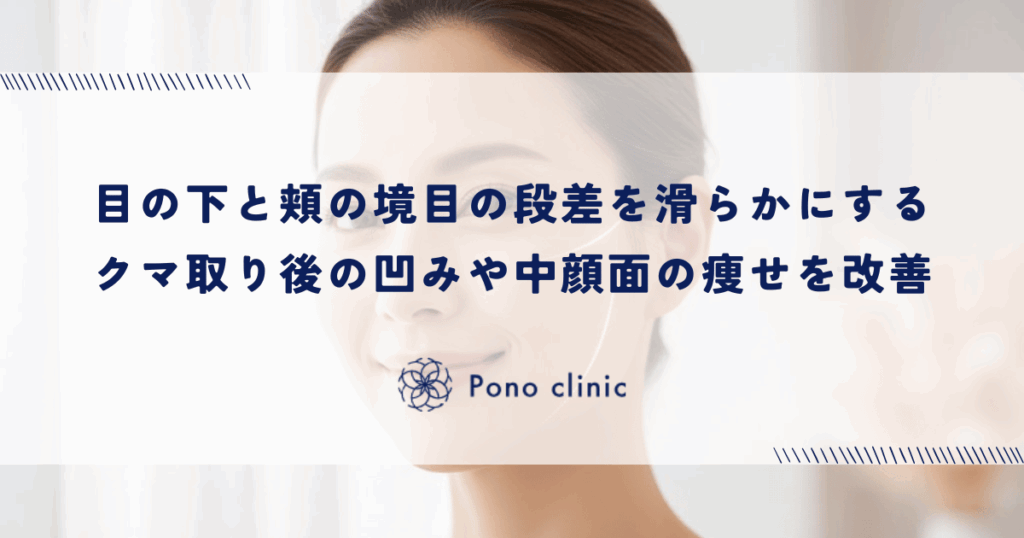 目の下と頬の境目（瞼頬溝）の段差を滑らかにする｜クマ取り後の凹みや中顔面の痩せを改善