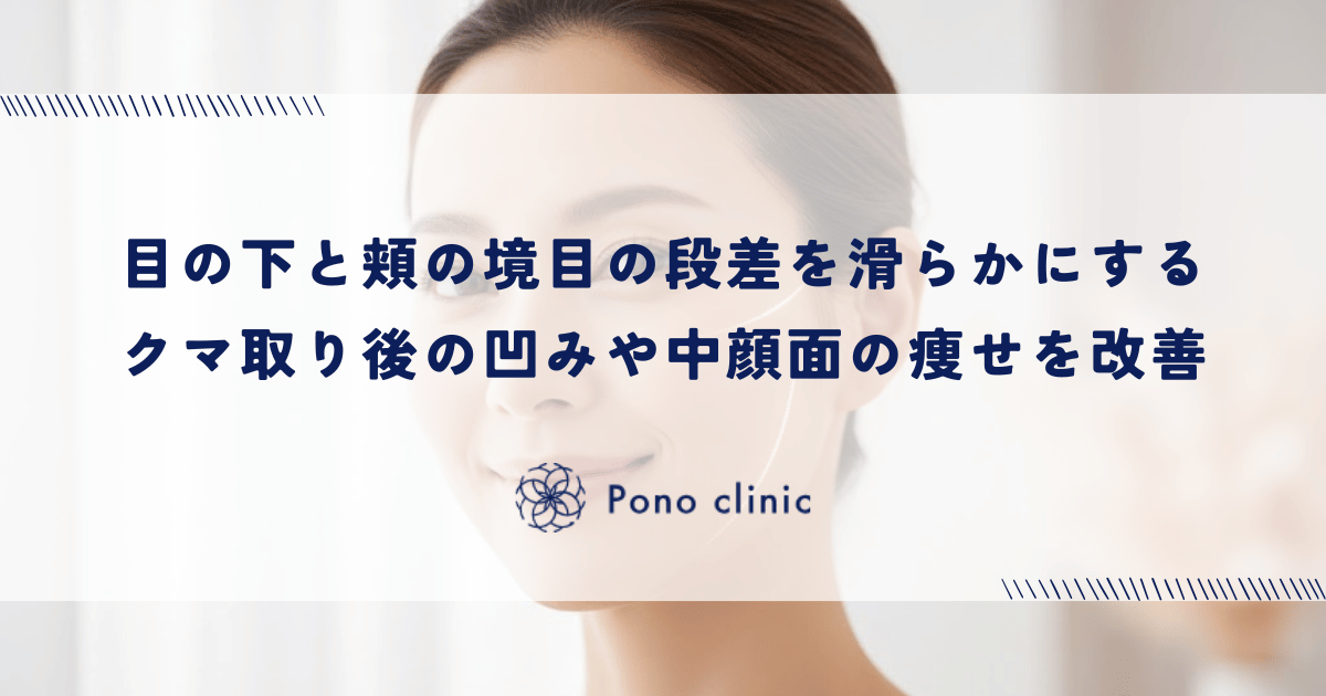 目の下と頬の境目（瞼頬溝）の段差を滑らかにする｜クマ取り後の凹みや中顔面の痩せを改善