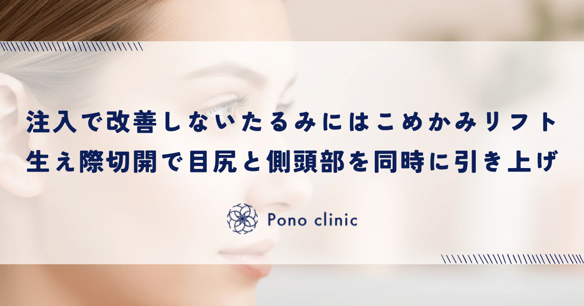 注入では改善しないたるみには「こめかみリフト」｜生え際切開で目尻と側頭部を同時に引き上げる