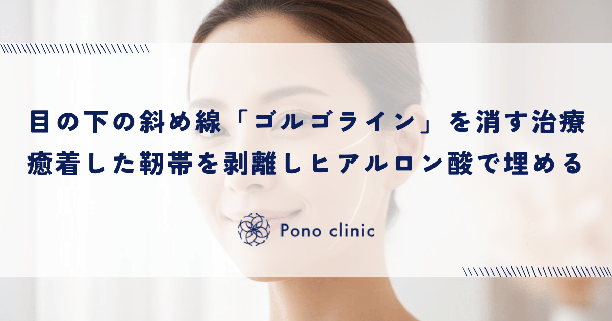 目の下の斜め線「ゴルゴライン」を消す治療｜癒着した靭帯を剥離しヒアルロン酸で埋める