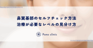 鼻翼基部のセルフチェック方法｜治療が必要なレベルの見分け方