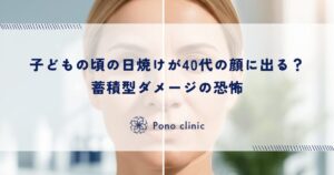 子どもの頃の日焼けが40代の顔に出る？蓄積型ダメージの恐怖
