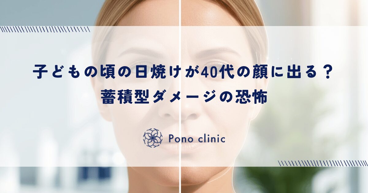 子どもの頃の日焼けが40代の顔に出る？蓄積型ダメージの恐怖