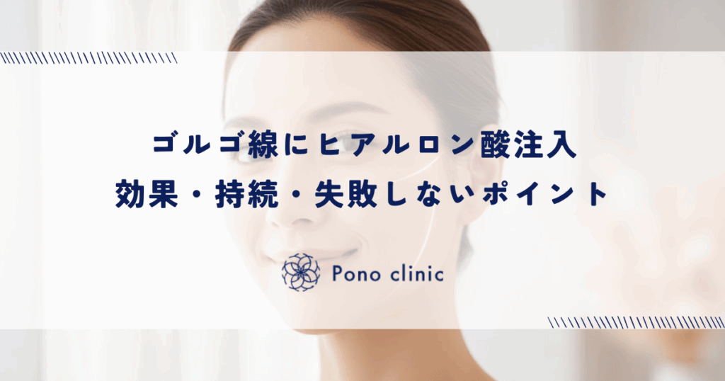 ゴルゴ線にヒアルロン酸注入｜効果・持続・失敗しないポイント