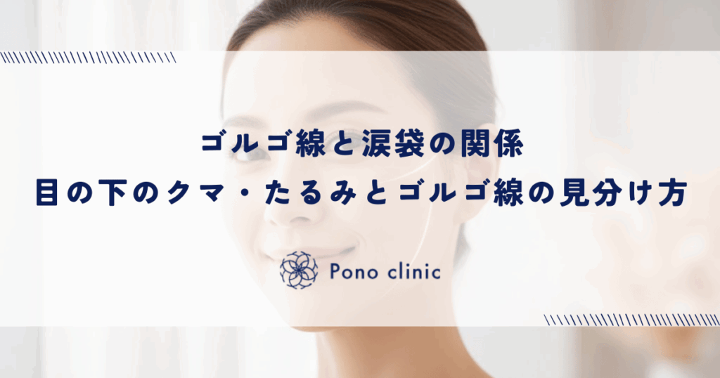 ゴルゴ線と涙袋の関係｜目の下のクマ・たるみとゴルゴ線の見分け方