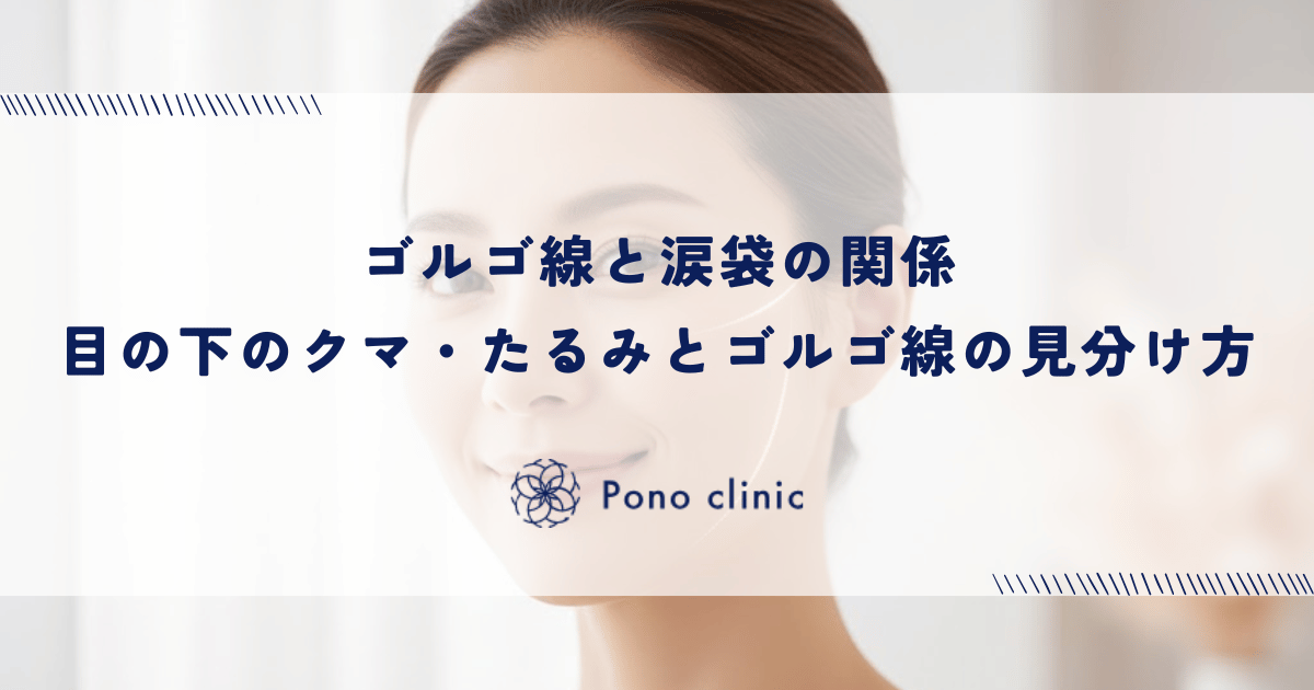 ゴルゴ線と涙袋の関係|目の下のクマ・たるみとゴルゴ線の見分け方