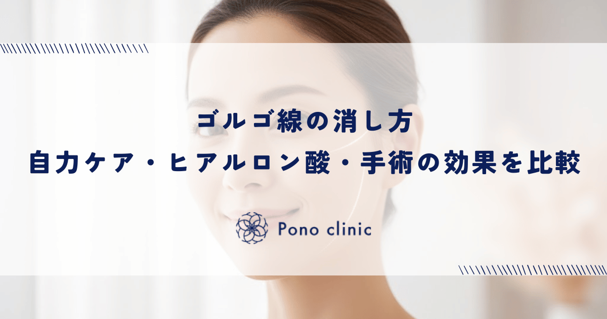 ゴルゴ線の消し方|自力ケア・ヒアルロン酸・手術の効果を比較