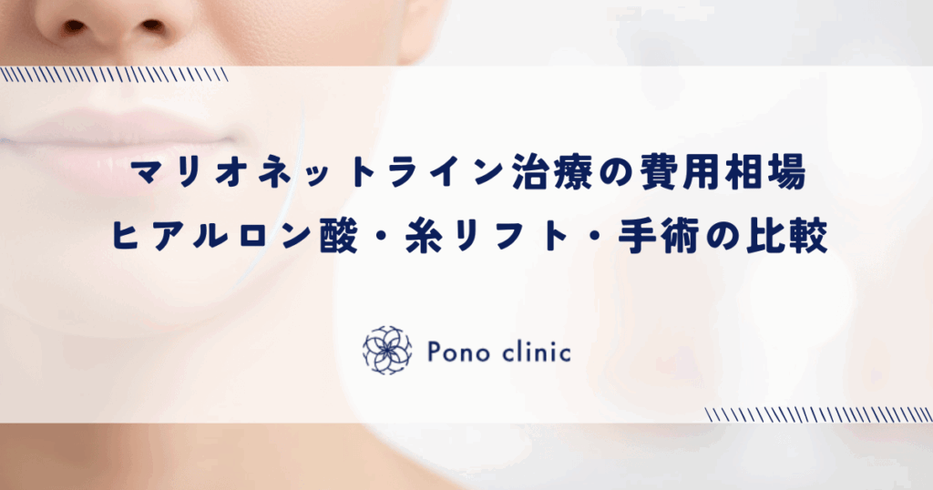 マリオネットライン治療の費用相場｜ヒアルロン酸・糸リフト・手術の比較