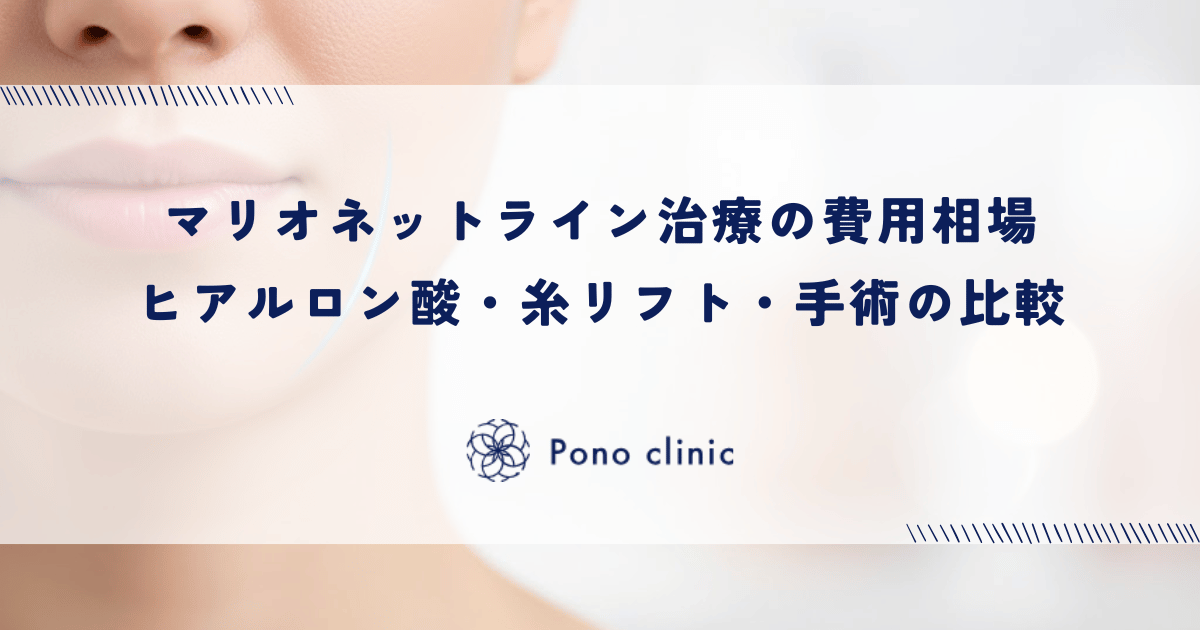 マリオネットライン治療の費用相場|ヒアルロン酸・糸リフト・手術の比較