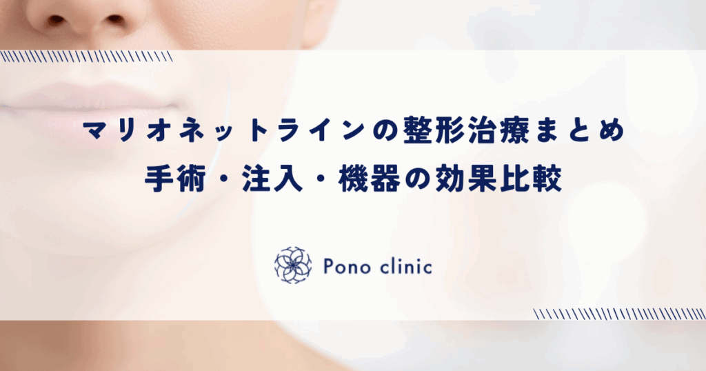 マリオネットラインの整形治療まとめ｜手術・注入・機器の効果比較