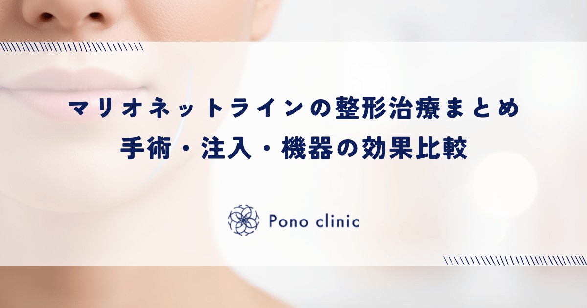 マリオネットラインの整形治療まとめ|手術・注入・機器の効果比較
