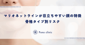 マリオネットラインが目立ちやすい顔の特徴｜骨格タイプ別リスク