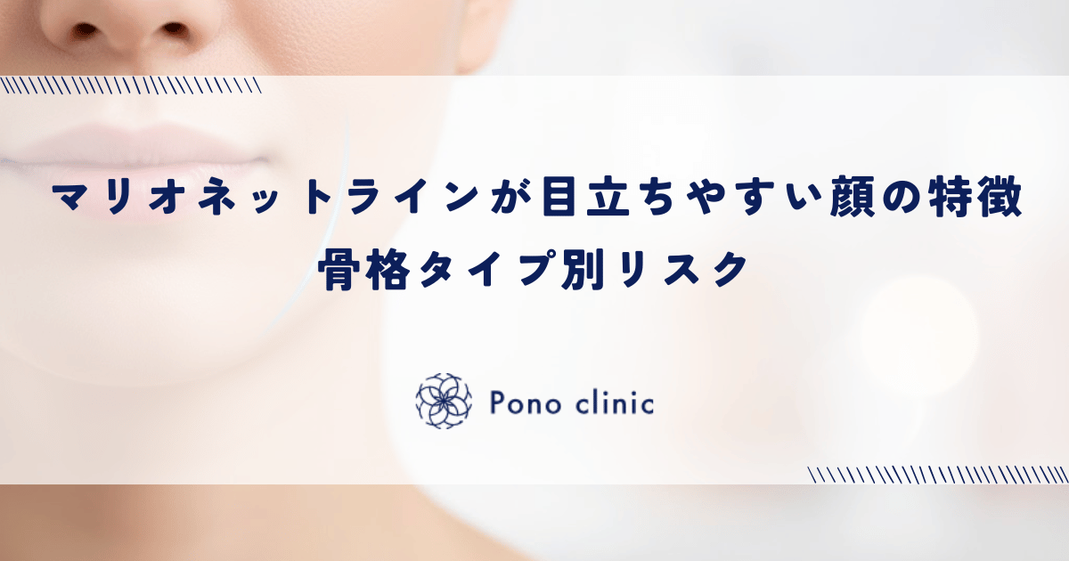 マリオネットラインが目立ちやすい顔の特徴|骨格タイプ別リスク
