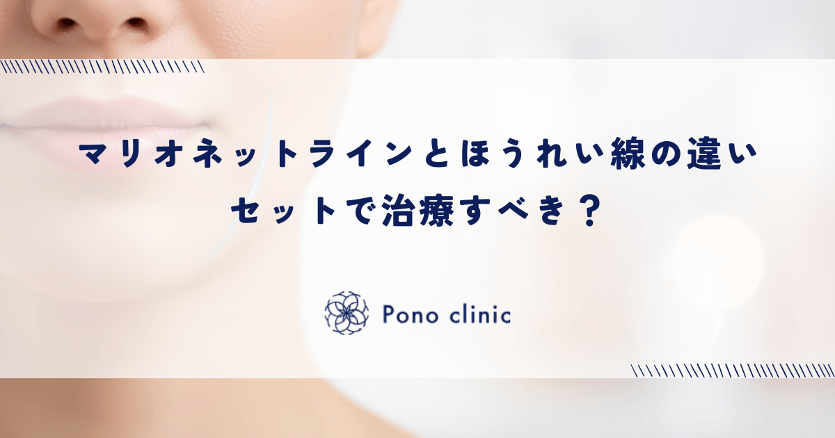 マリオネットラインとほうれい線の違い|セットで治療すべき?