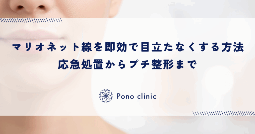 マリオネットラインを即効で目立たなくする方法｜応急処置からプチ整形まで