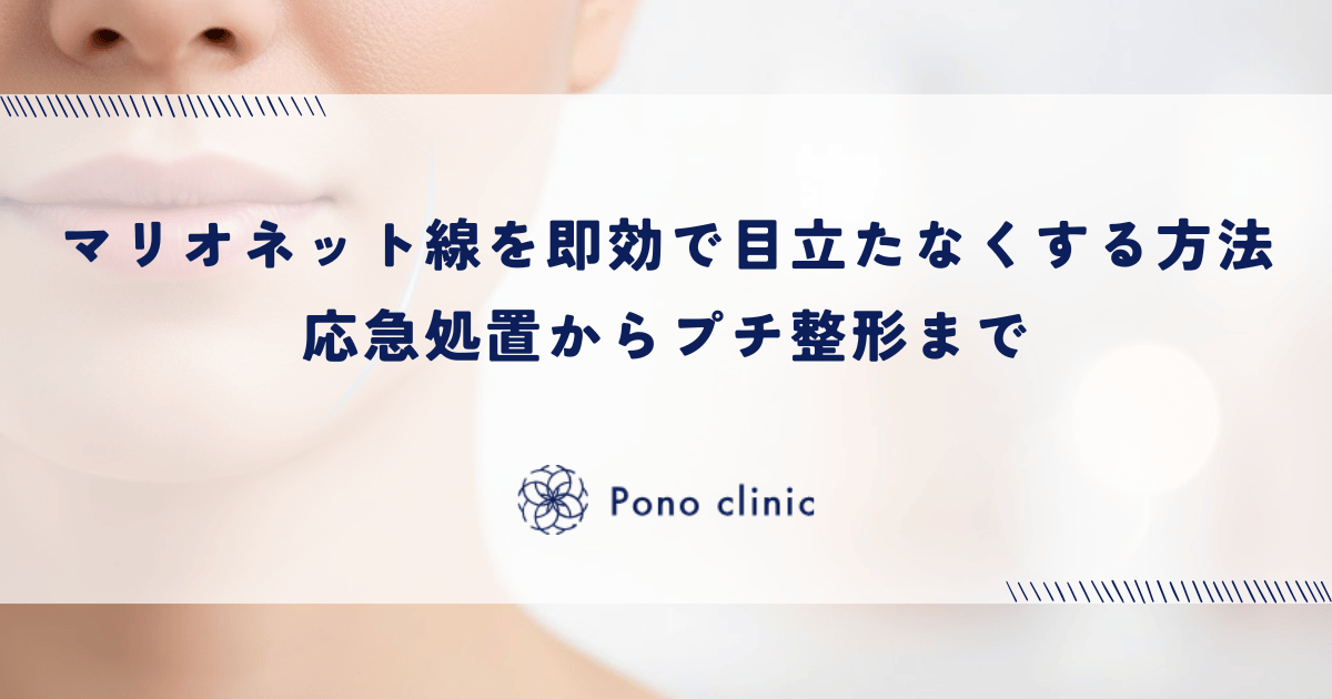 マリオネットラインを即効で目立たなくする方法|応急処置からプチ整形まで