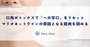 口角ボトックスで「への字口」をリセット｜マリオネットラインの原因となる筋肉の力を弱める
