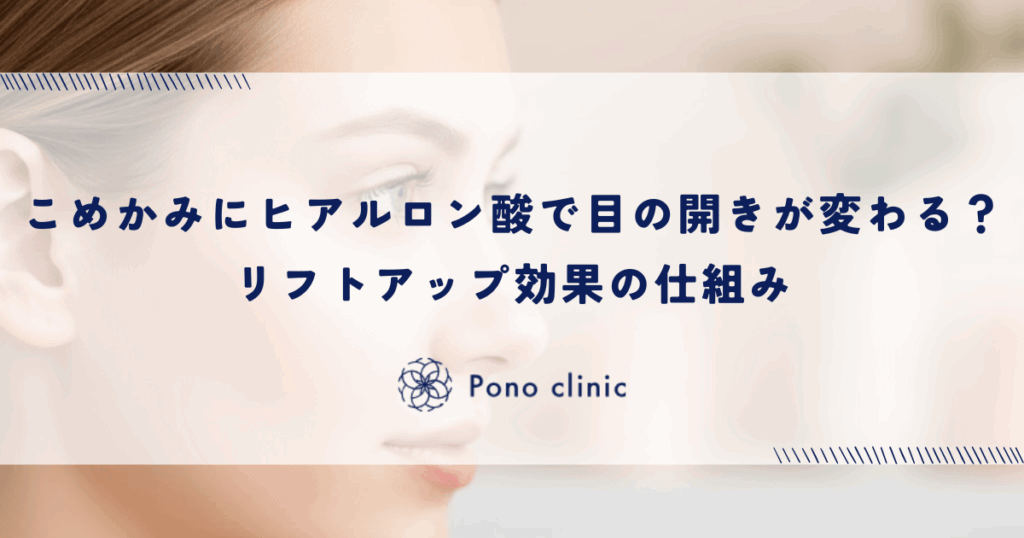 こめかみへのヒアルロン酸で目の開きが変わる？リフトアップ効果の仕組み