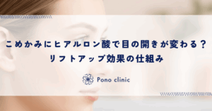 こめかみへのヒアルロン酸で目の開きが変わる？リフトアップ効果の仕組み