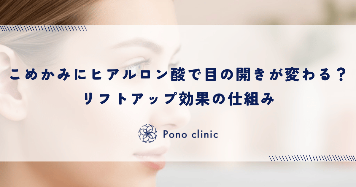 こめかみへのヒアルロン酸で目の開きが変わる?リフトアップ効果の仕組み
