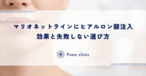 マリオネットラインにヒアルロン酸注入｜効果と失敗しない選び方
